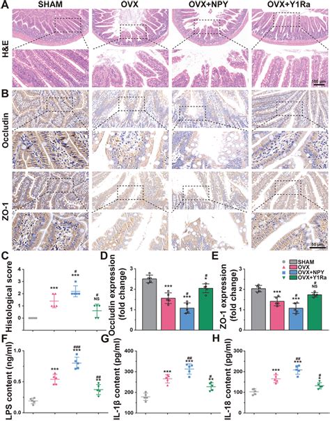 NPY And Y1R Antagonist Changed The Intestinal Barrier Integrity In OVX