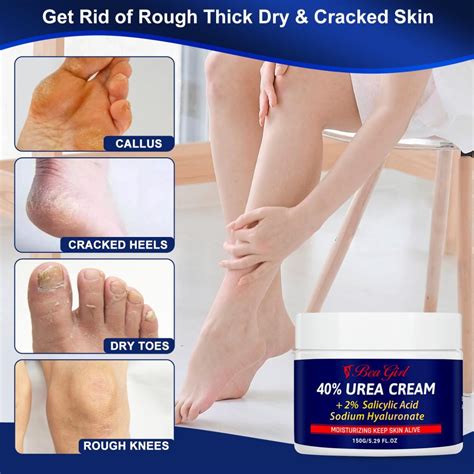 8 Best Urea Cream For Feet 2023 Hummingbirds Plus