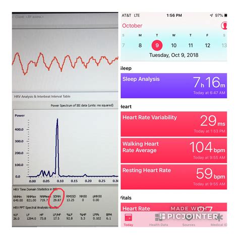 Heart Rate Variability Chart Apple Watch Ponasa