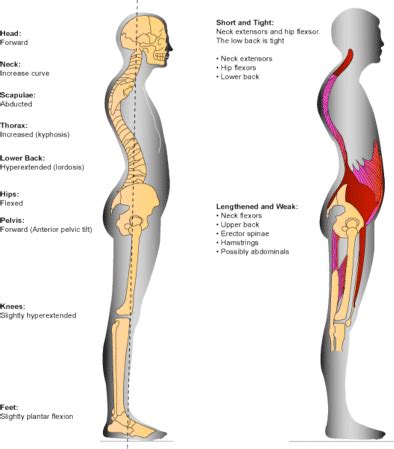 One Last Hypermobility Chat: The Knees — Musicians' Health Collective