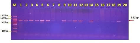 Image Of Agarose Gel Electrophoresis Showed Pcr Product Of K54 Serotype