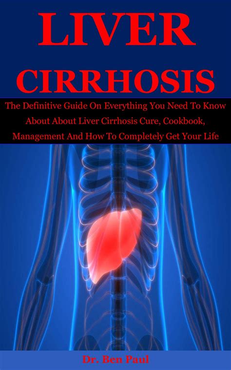 Buy Liver Cirrhosis The Definitive Guide On Everything You Need To