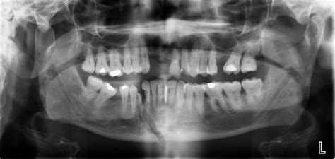 Dental Trauma Guidelines – Health Brisbane