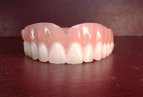 Denture upper false teeth by denturestore on Etsy