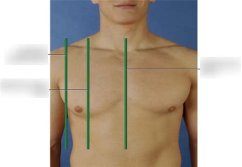 Thorax And Lungs Anterior Reference Lines Diagram Quizlet