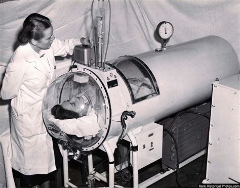 Iron Lungs For Polio Victims 1930s 1950s Rare Historical Photos