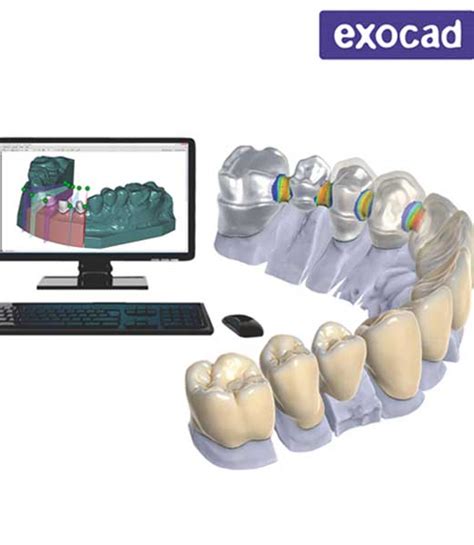 Exocad Software Dental Software Dental De Venta En 3DMARKET