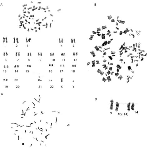 A G Banded Metaphase And Karyotype Shows Xy I Q B A