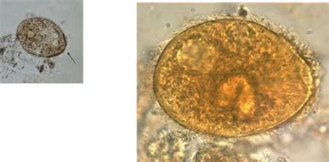 Micro Lecture 5 Ciliates And Flagellates Pictures Flashcards Quizlet