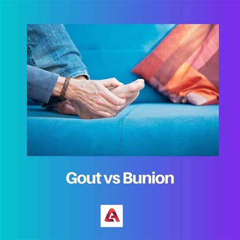 Gout Vs Bunion Difference And Comparison