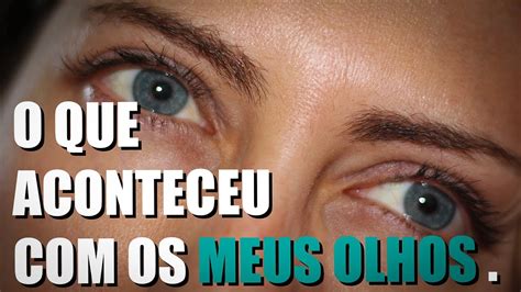 O Que Aconteceu Os Meus Olhos Youtube