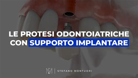 Le Protesi Odontoiatriche Con Supporto Implantare Dr Stefano Montuori