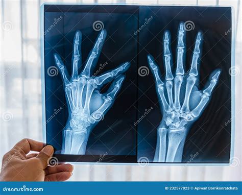 Medical X Ray Fluoroscopy Instrument Stock Photography Cartoondealer