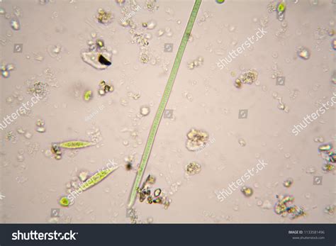 Microorganisms In Pond Water Under Microscope