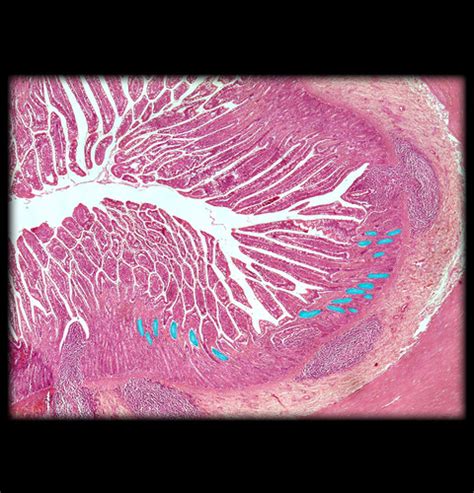 Ileum Histology Flashcards Quizlet