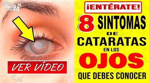 8 SÍntomas De Cataratas En Los Ojos Y Sus Tratamientos Naturales