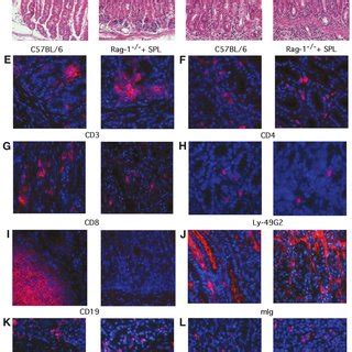 Histologic Comparison Between C57BL 6 Mice And Recipient Rag 1 Mice