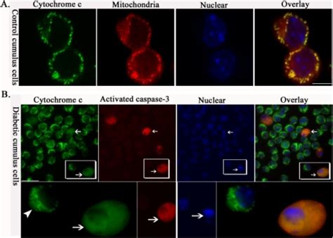 Cytochrome C Translocation And Caspase 3 Activation In Open I