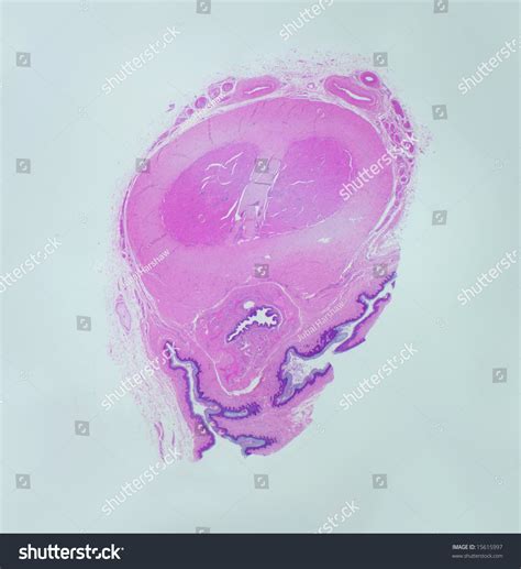 Microscopic Cross Section Mammalian Penis Showing Stock Photo 15615997