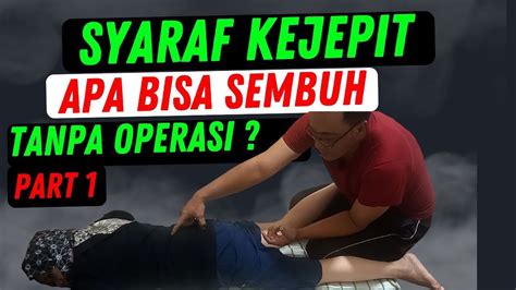 Syaraf Kejepit Apakah Bisa Sembuh Tanpa Operasi Part 1 YouTube