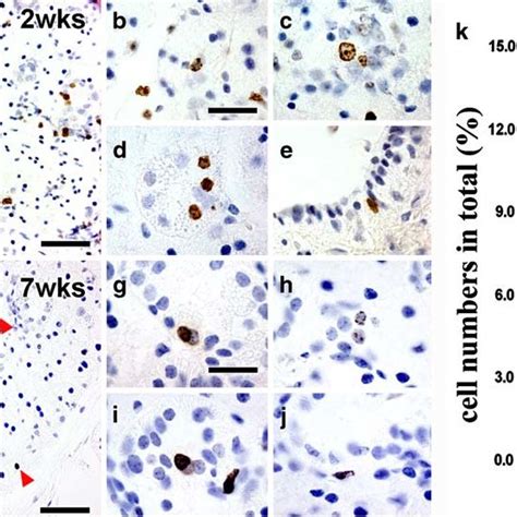 Existence Of LRCs In Mouse SMG The BrdU Labeling Method Was Used To