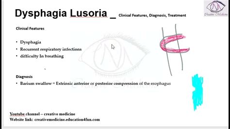 Lec 3 Dysphagia Lusoria Clinical Features Diagnosis Treatment Mp4