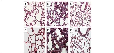 Histopathological Analysis Of Lung Tissue A D Sham Group B E Va