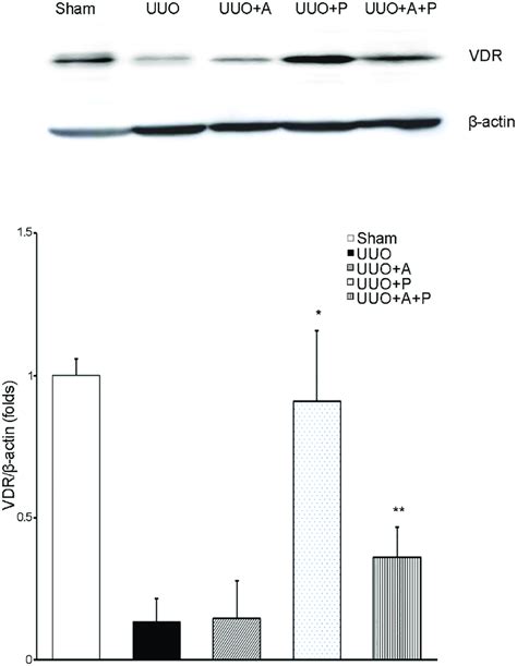 Effect Of Aliskiren Or Paricalcitol Monotherapy Or Combination