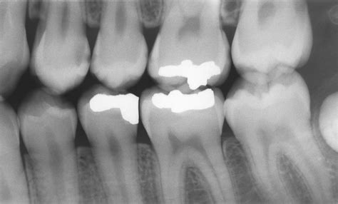 The Periodontal Assessment - Revise Dental