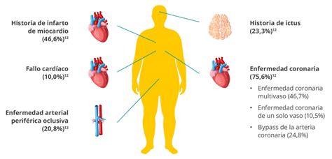 Cardiorrenal Es Abordaje Del Riesgo Cardiovascular En Tus Pacientes