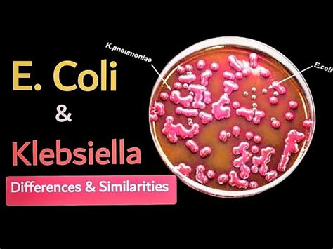 Klebsiella Pneumoniae Emb