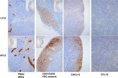 Immunohistochemical Analysis Of Lymph Nodes Mandibular Lymph Nodes