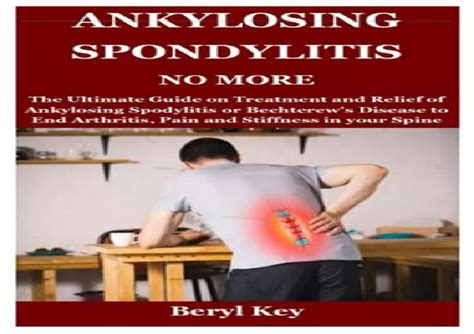 Ppt Epub Ebook Ankylosing Spondylitis No More The Ultimate Guide