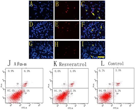 Pc12 Cells Of Aβ2535 Injury Group Ac Resveratrol Protection Group