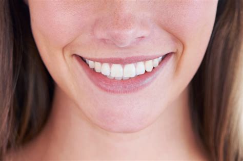 Anatomy Of A Smile Makeover A Comprehensive Guide To Getting A Better