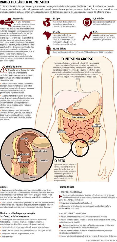 Câncer De Intestino Está Entre Os Que Mais Crescem No Brasil Mas