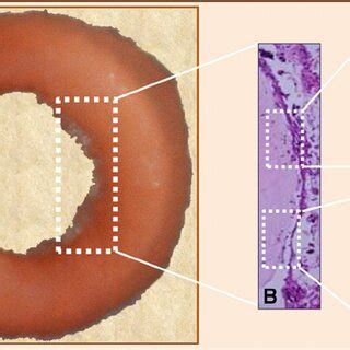 Creation of blastema cells at the cut edge of the ring. ( A ) Biopsied ...