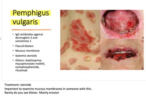 Blistering Conditions And Systemic Disease Flashcards Quizlet