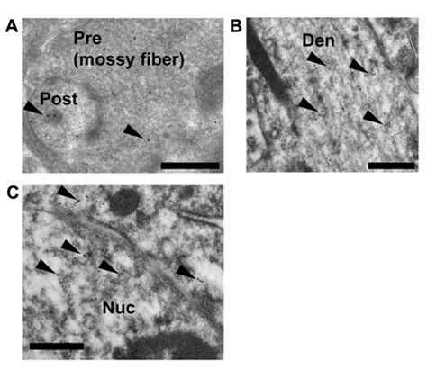 Immunoelectron Microscopic Analysis Of The Distribution Of Gr Within