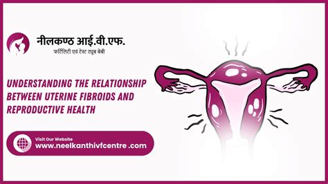 Understanding The Relationship Between Uterine Fibroids And