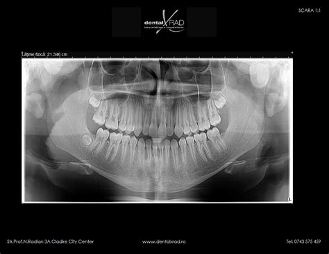 Tipuri De Radiografii Dentare