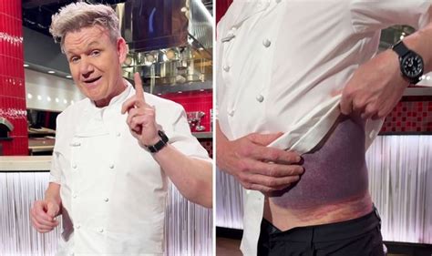 Gordon Ramsay Says He S Lucky To Be Alive After Bike Accident And