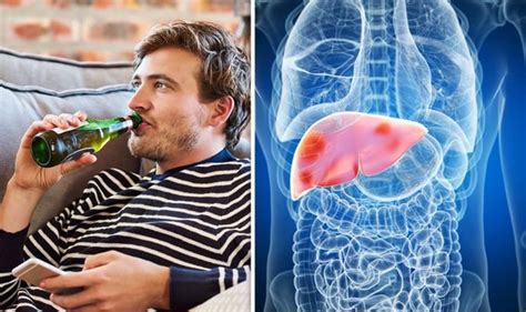 Alcoholic Fatty Liver Disease Would You Classify Yourself As A Heavy