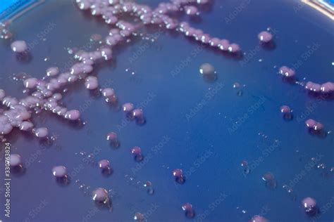 Bacterial Colonies On Agar Medium Petri Dish Plate Plate On Macconkey