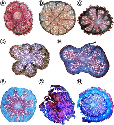 Light Micrographs Of Stem Cross Sections In Malpighiaceae Showing