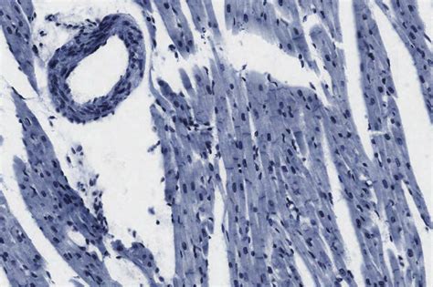 Lab 7 Cardiac Muscle Histology Diagram Quizlet