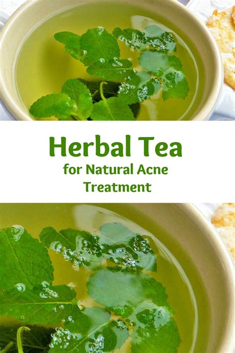 Natural Acne Treatment Herbal Tea Recipe Healing Bookstore