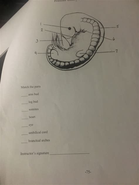 Solved Label The Following Structures Male Reproductive