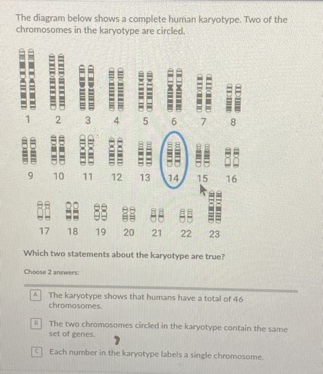 Solved The Diagram Below Shows A Complete Human Karyotype Two Of The