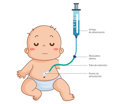 Nutrici N Enteral Generalidades Youtube